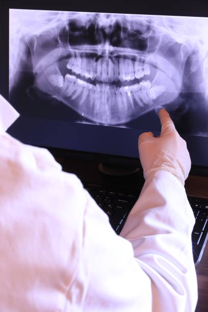 Best Dental Abscess Treatment in Rmichael, CA