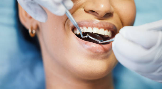 Best Emergency Care for Gum Disease in Rmichael, CA