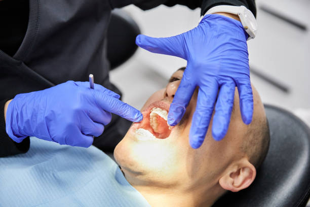Best Emergency Denture Repair in Rmichael, CA
